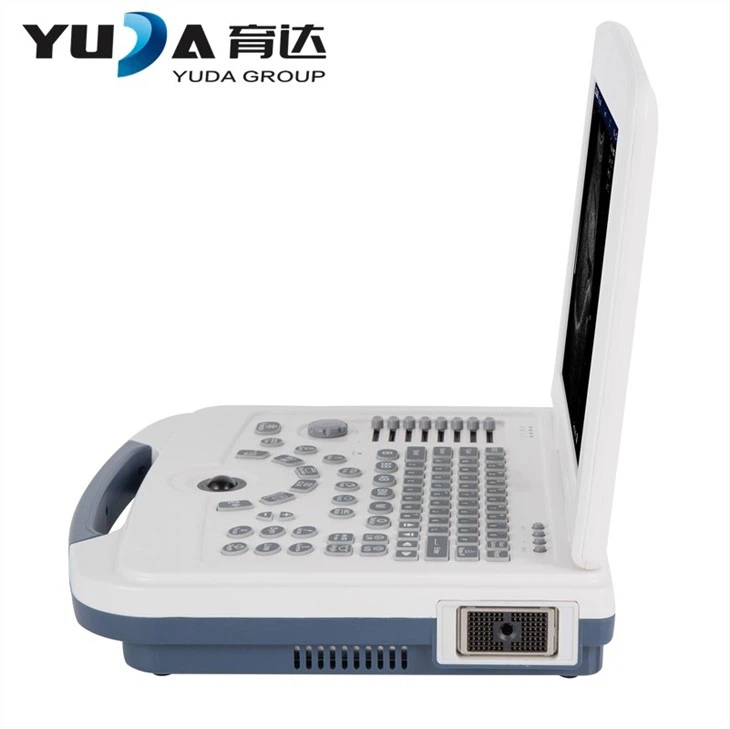 Full Digital Laptop High-end Ultrasound 3D Scanner