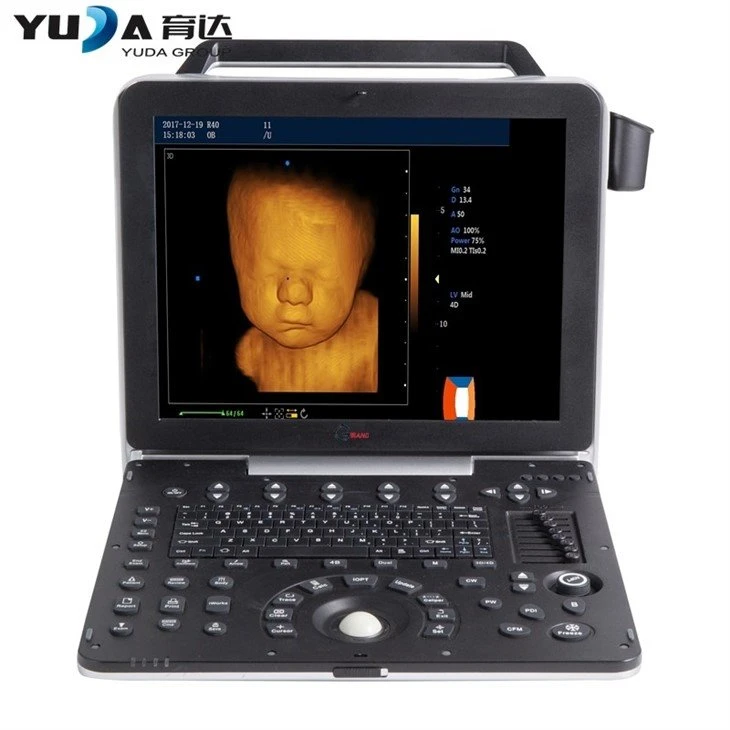 Portable OB GYN Ultrasound Machines